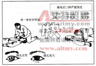 救治触电者的技术方法